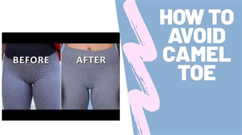 how to get rid of camel toe|3 Ways to Prevent Camel Toe